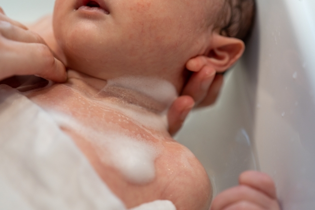 乳幼児のアレルギー予防のキモは 洗浄と保湿 ココフル 乳幼児のアレルギー予防のキモは 洗浄と保湿 ココフル